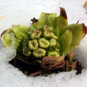 春の花粉症の発症の仕組み