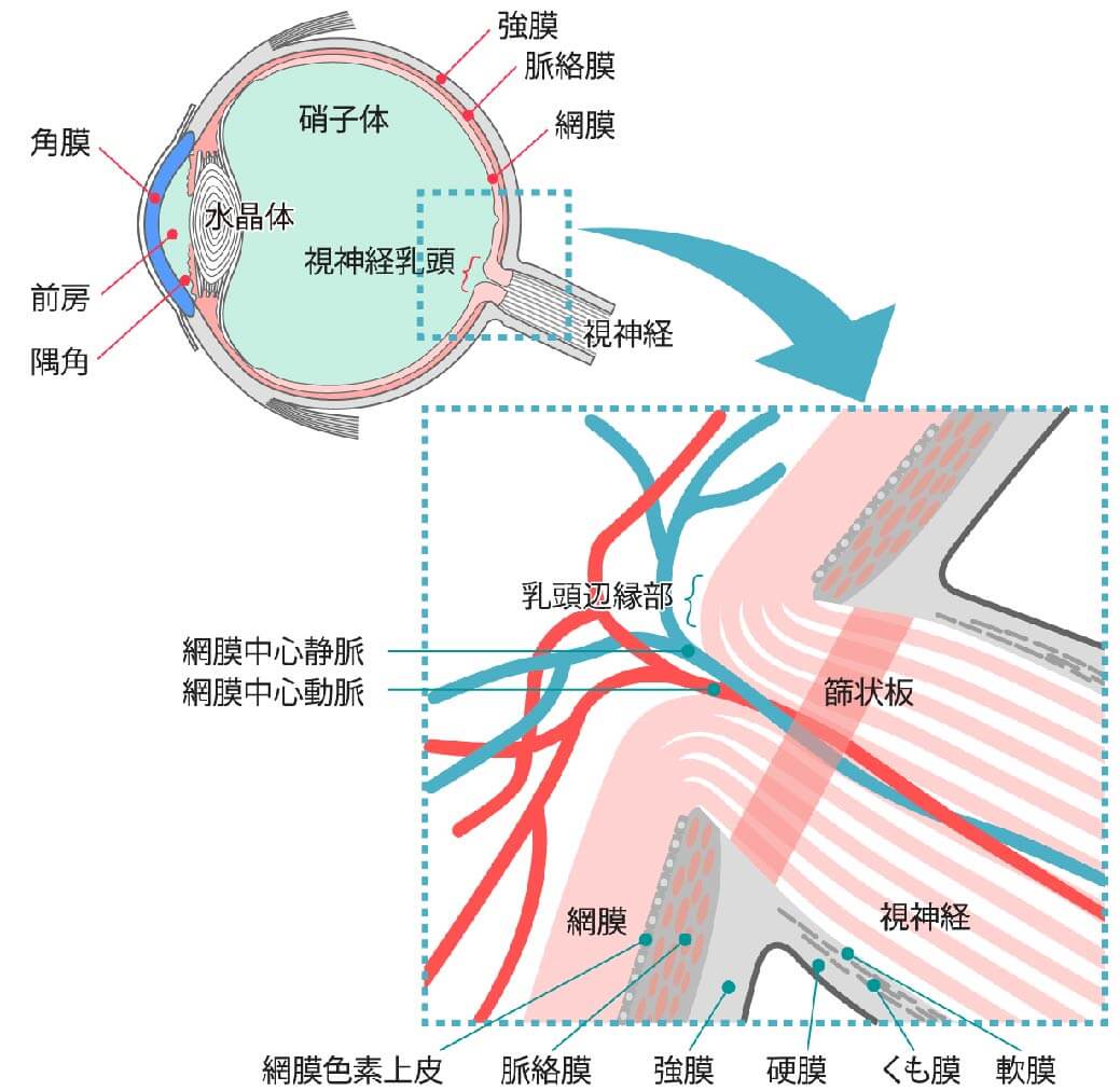 緑内障の病態と症状