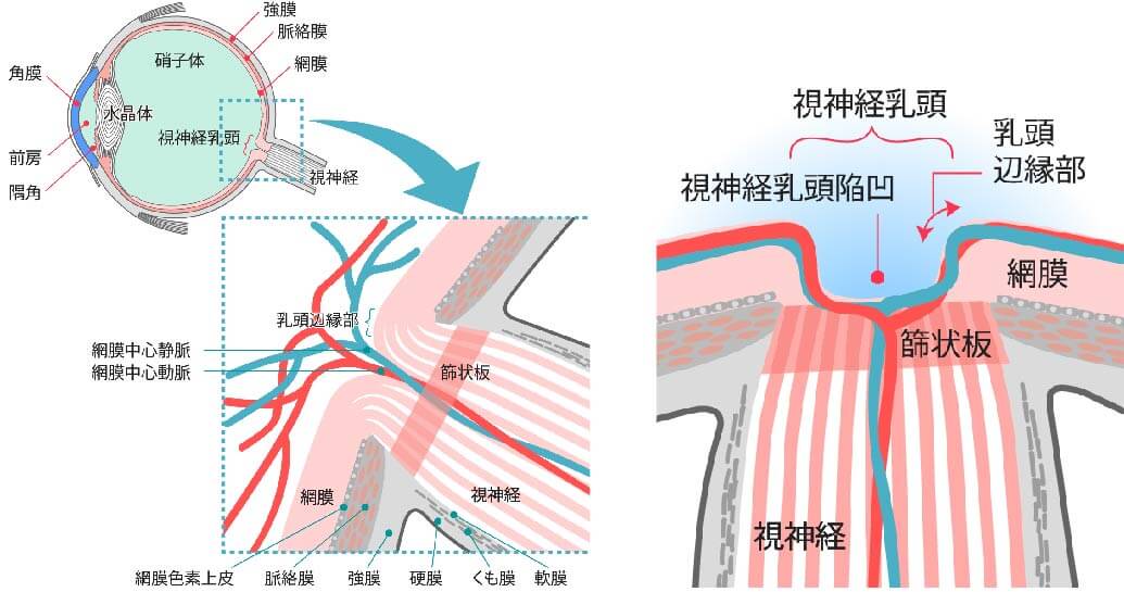 緑内障の原因