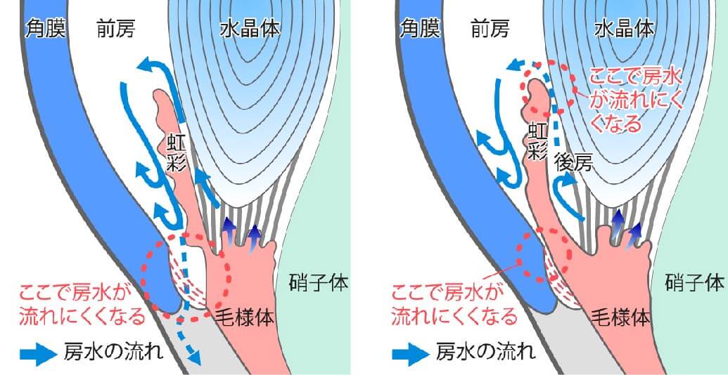 房水の流れ