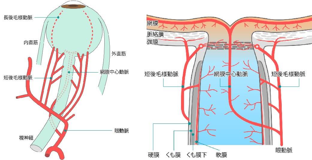 正常眼圧緑内障とは